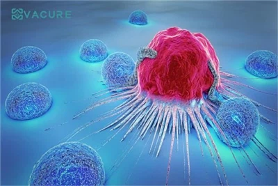 14 Prevention Advice to stay away from cancer